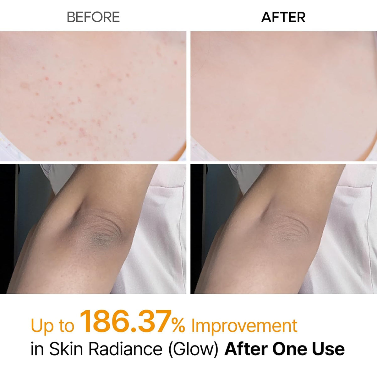 The Professional Body Resurfacing Mist