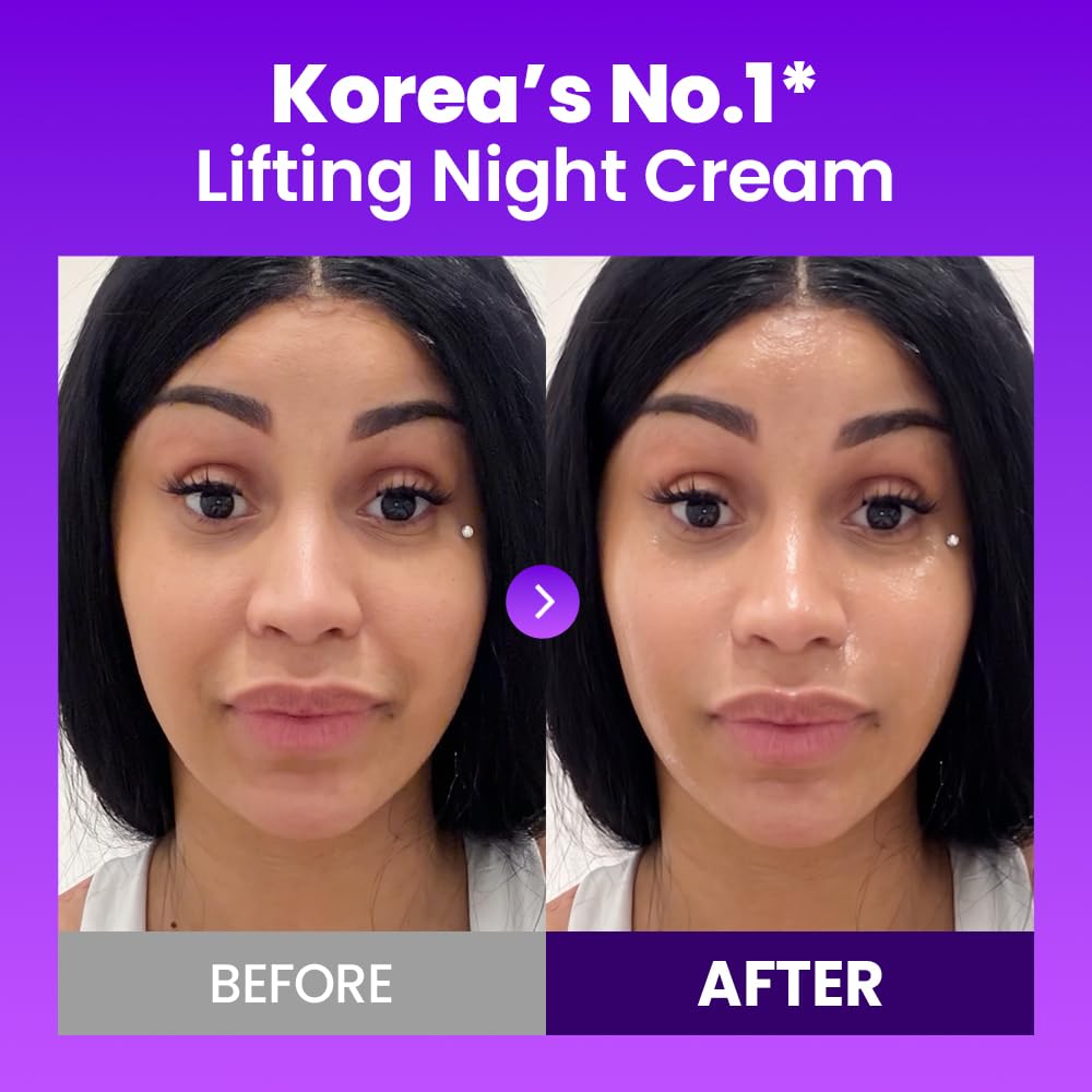 Sculpt Your Youth with 3D Lifting Technology