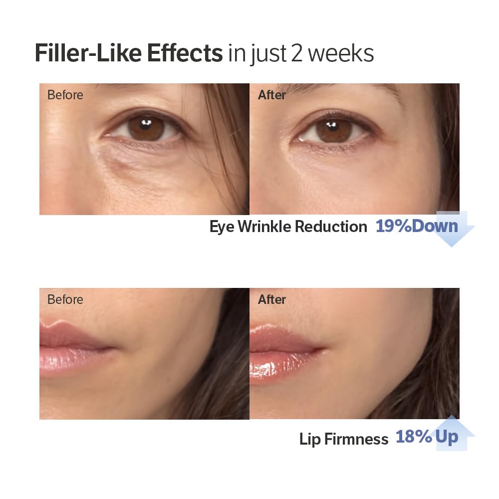 Plump, Bouncy & Glass-Like Skin