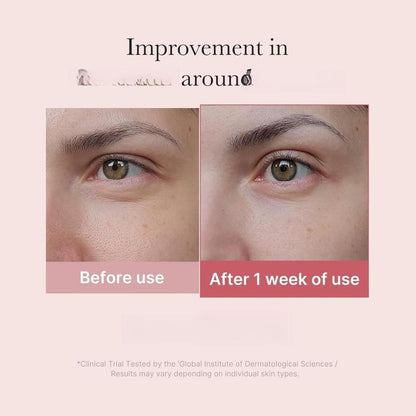 Eye Serum - PDRN & 99% Retinol Complex For Visible Under-Eye Firming & Brightening