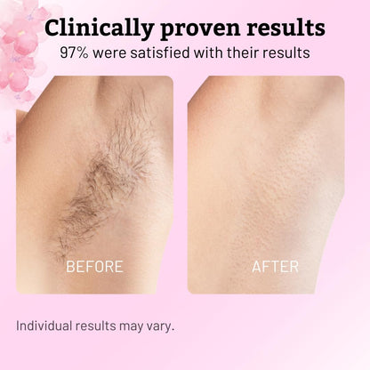 Cyperus Rotundus Hair Reduction Oil – Post-Shaving Skin Smoothing Botanical Formula