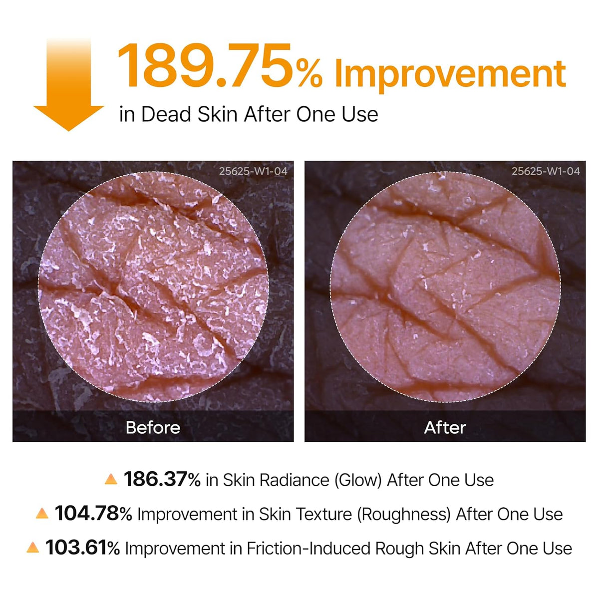 The Professional Body Resurfacing Mist