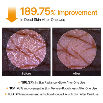 The Professional Body Resurfacing Mist