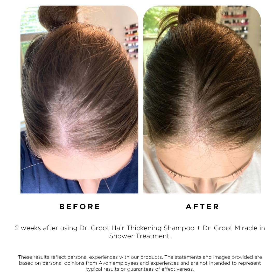 Revitalize Your Scalp & Restore Visibly Thicker Hair