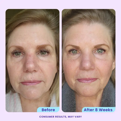 Daily Renewal Wrinkle‑Fighting Peptide Moisturizer