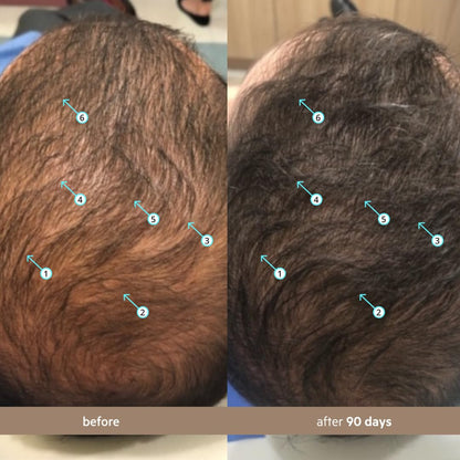 Regain Your Crown: The Science-Backed Breakthrough for Thicker, Fuller Hair.