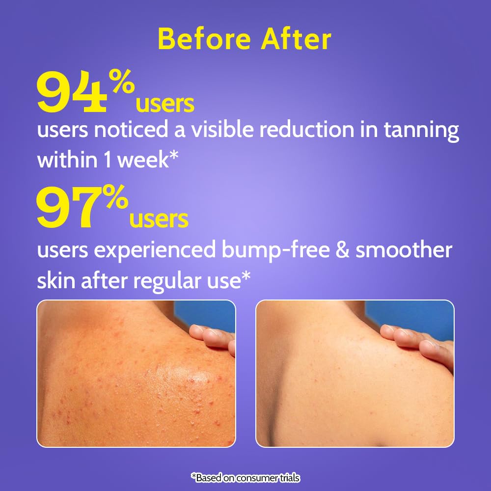 Exfoliating Body Wash – 4% Lactic & Salicylic Acid Complex For Smoother Bumpy Skin