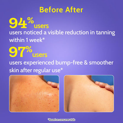 Exfoliating Body Wash – 4% Lactic & Salicylic Acid Complex For Smoother Bumpy Skin