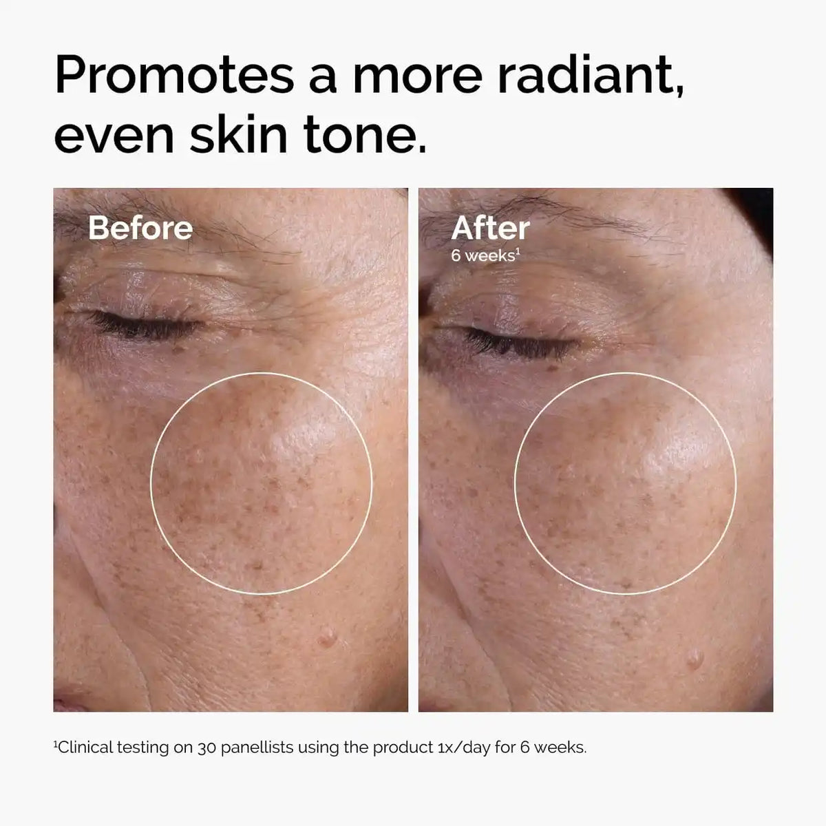 Exfoliating Liquid – 7% Glycolic Acid & Botanical Elixir For Smooth, Bump-Free & Radiant Skin