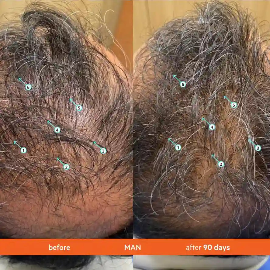 Hair Density Shampoo – 21+ Bio-Active Nutrient Delivery For Thicker, Fuller-Looking Hair