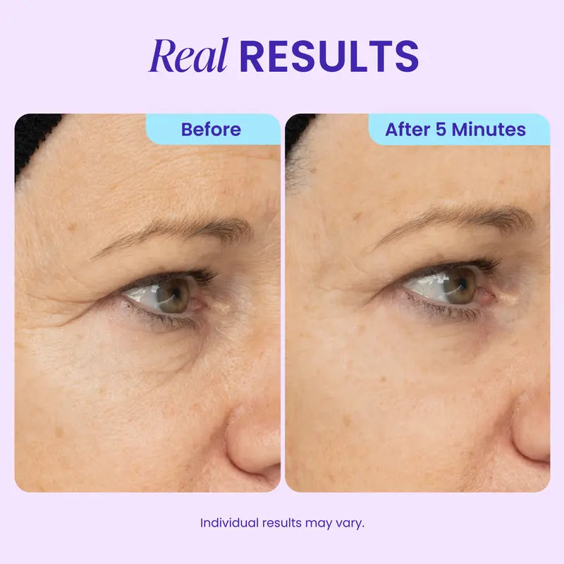 Instant Lift Eye Gel – Biotech Collagen Matrix For Immediate Eye Bag & Wrinkle Reduction