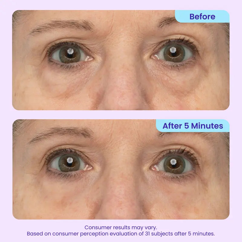 Instant Lift Eye Gel – Biotech Collagen Matrix For Immediate Eye Bag & Wrinkle Reduction