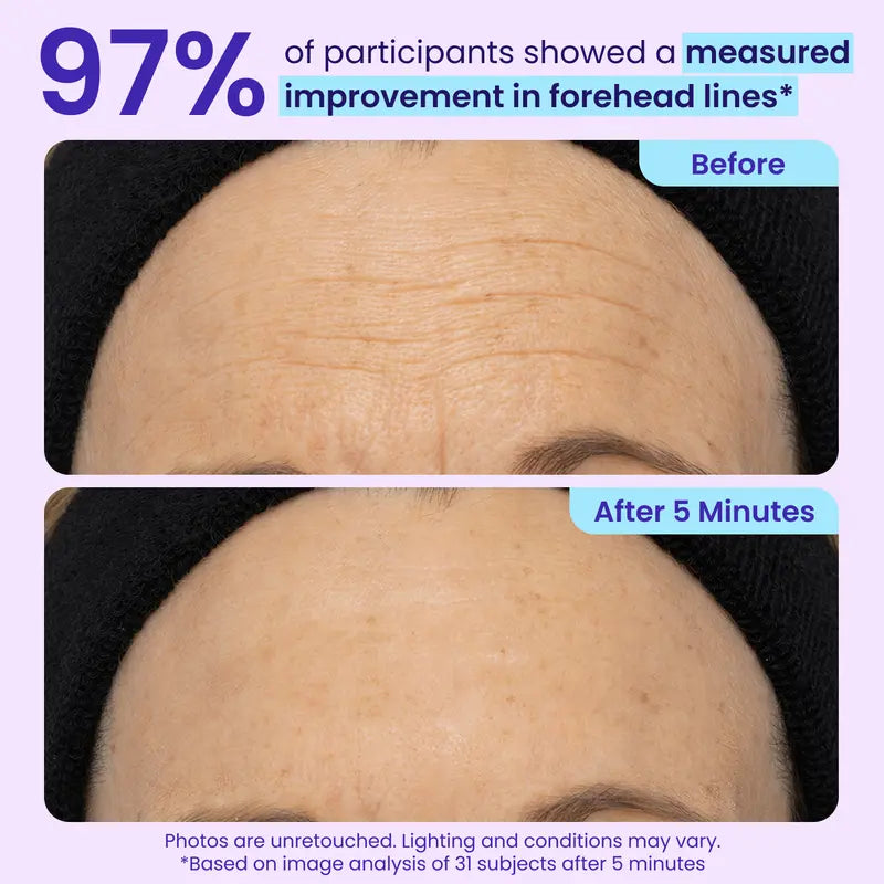 Instant Lift Eye Gel – Biotech Collagen Matrix For Immediate Eye Bag & Wrinkle Reduction