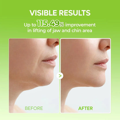 V-Lifting Mewing Band – Cactus Ice Cooling For Instant Chin & Jawline Sculpting