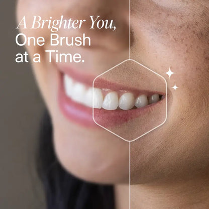 Nano-Hydroxyapatite Toothpaste –  Complete Sensitivity Relief & Gentle Whitening